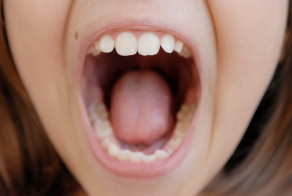Respiração pela boca na infância pode deformar a face e prejudicar a saúde